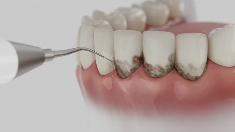 Reliable Tooth Extraction contractor in St. Maries, ID by Smile Center Dentistry